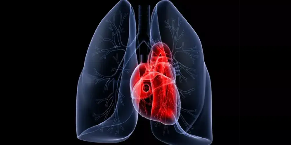 فرط ضغط الشريان الرئوي   Pulmonary artery hypertension  PAH
