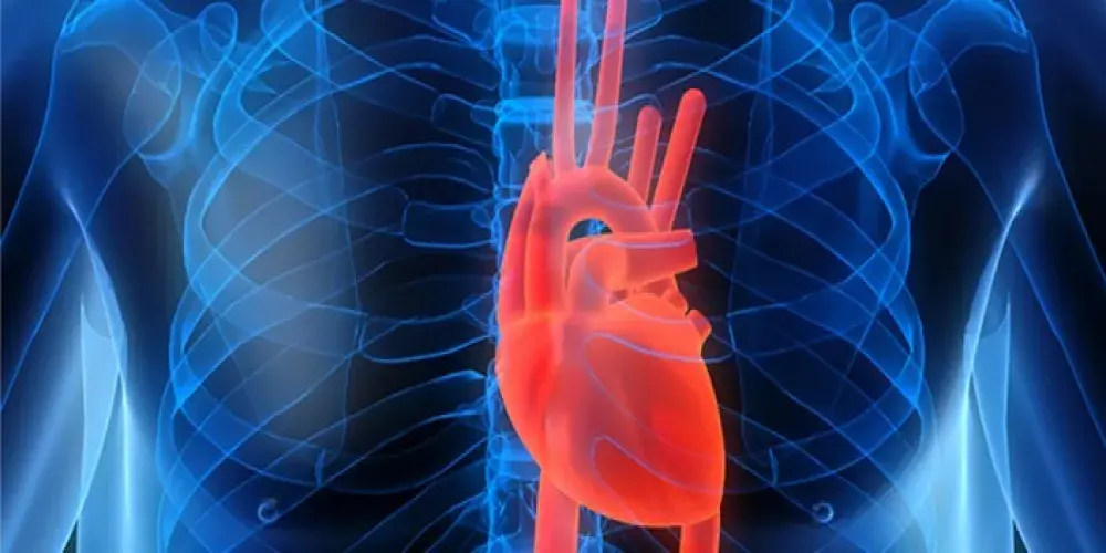 معلومات تهمك حول متَلازِمَةُ لوريش Leriche's syndrome