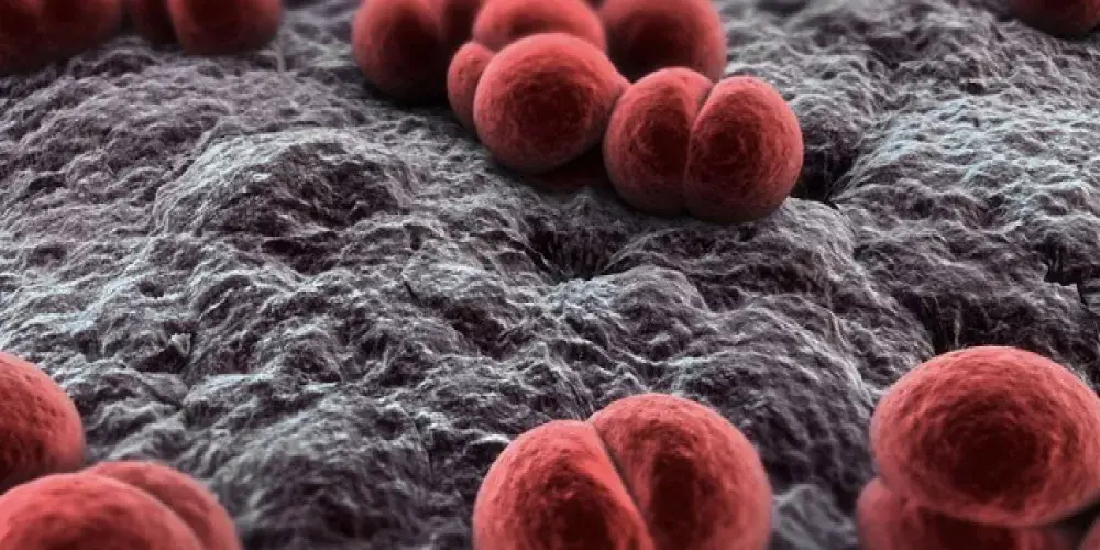 ما يجب أن تعرفه عن الالتهاب السحائي