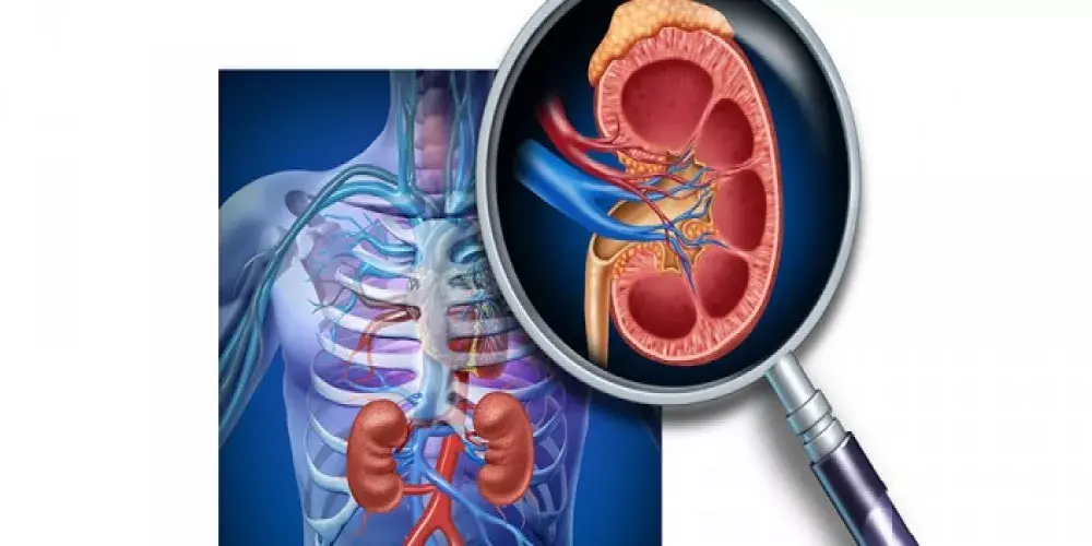 الفشل الكلوي وكيفية التعامل معه