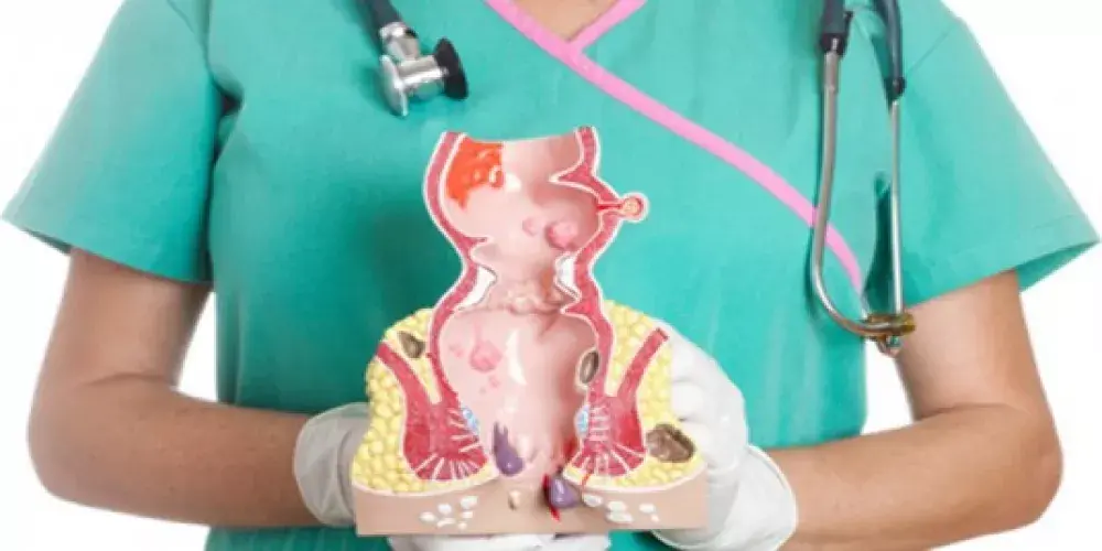 معلومات عامة عن البواسير