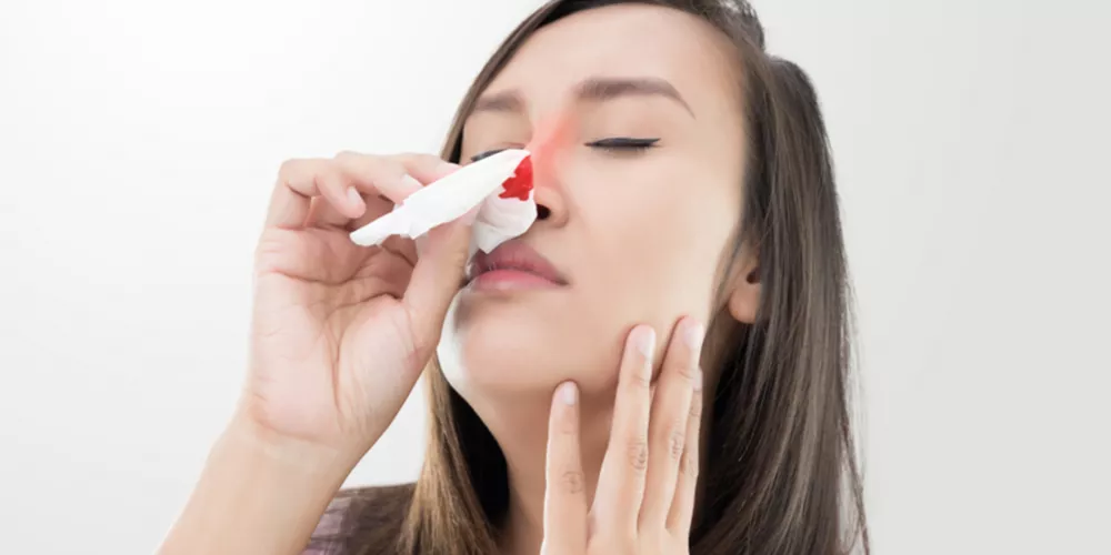 ما هي أسباب نزيف الأنف؟