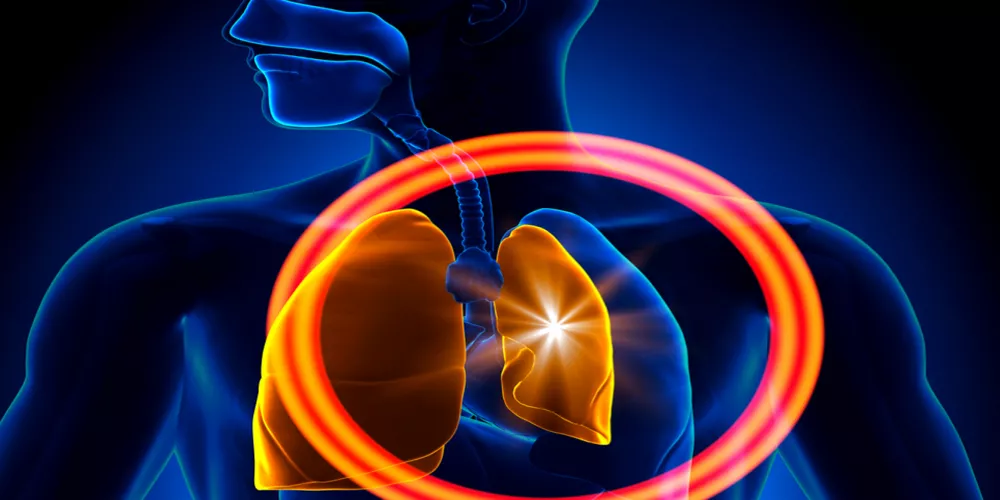 ما هو الاسترواح الصدري؟