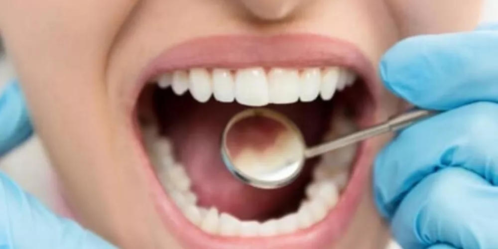 تأثير ارتجاع المريء على صحة الفم والأسنان 