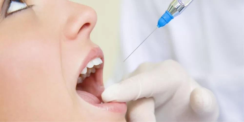 بنج الاسنان أنواعه آثاره مدة تأثيره ومضاعفاته | الطبي