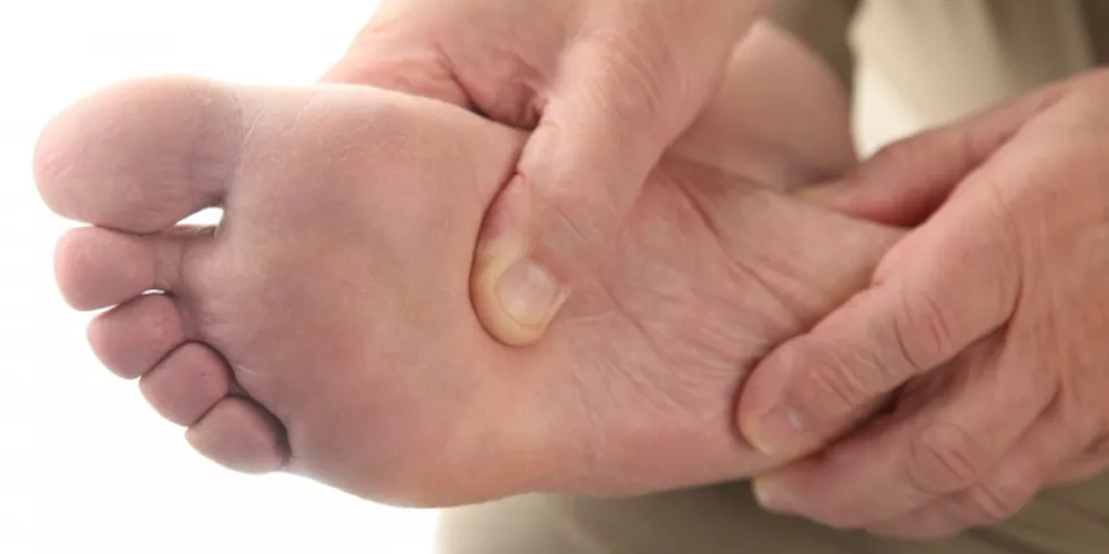 مسامير القدم - الوقاية والعلاج