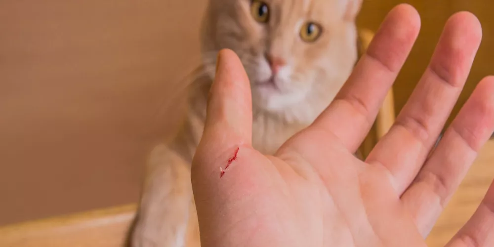 معلومات حول داء خدش القطة