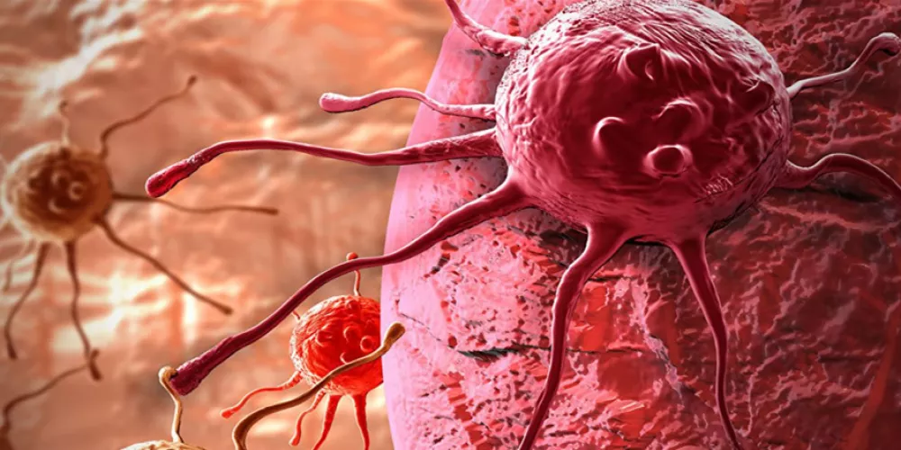 الحمى الغدية وتشخيصها