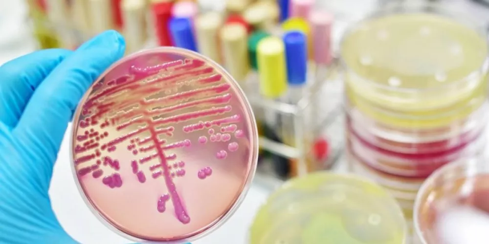 التهاب السحايا - الأعراض والعلاج