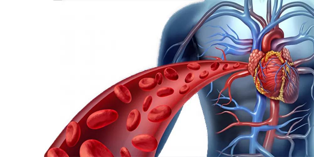 مرض نقص تروية القلب- داء القلب الاقفاري