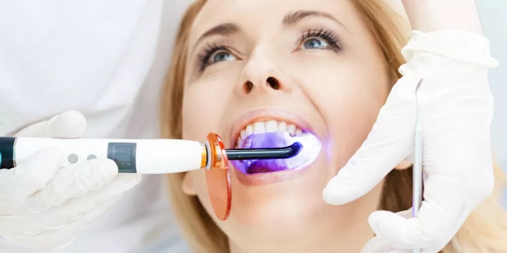تبييض الاسنان (Teeth Bleaching) | الطبي