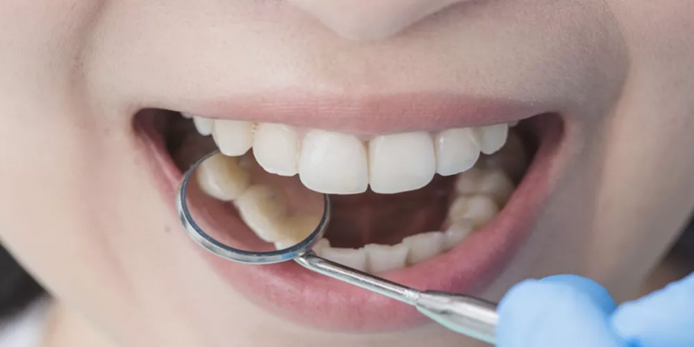 احد اصناف اسنان الفم في الانسان