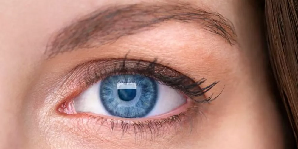 تصحيح انحراف العين بتقنية الليزر