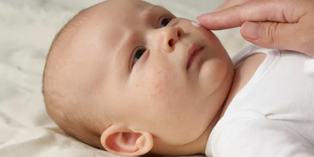 جفاف بشرة الرضيع وطرق علاجها