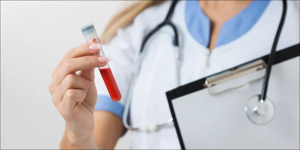  دراسة تؤكد أن فصيلة الدم لا تؤثر على الإصابة بفيروس كورونا