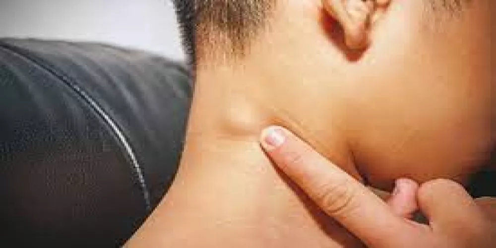 الغدد اللمفاوية