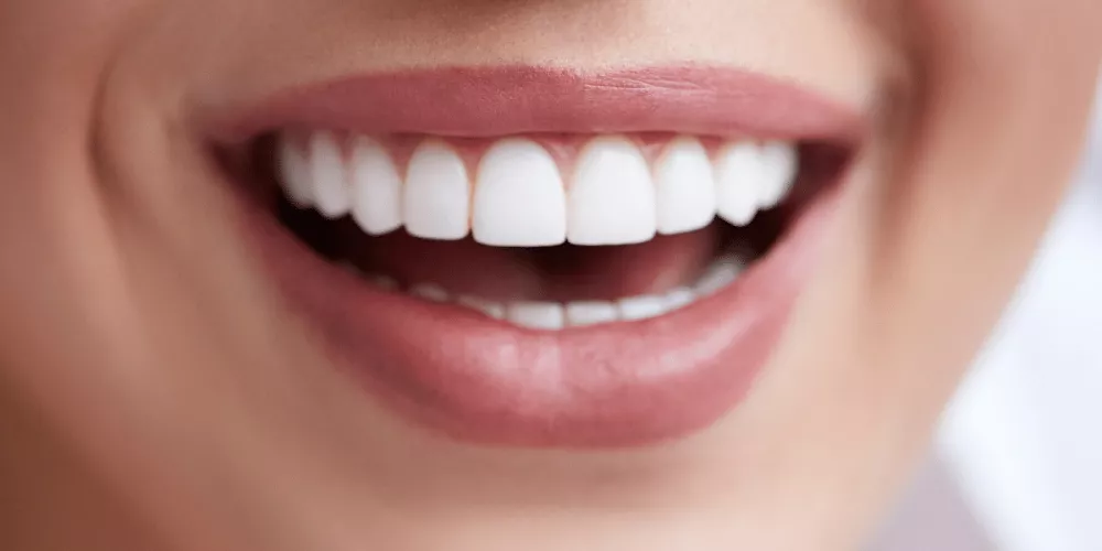 كل ما تريد معرفته عن فينير الاسنان، وانواعها | الطبي