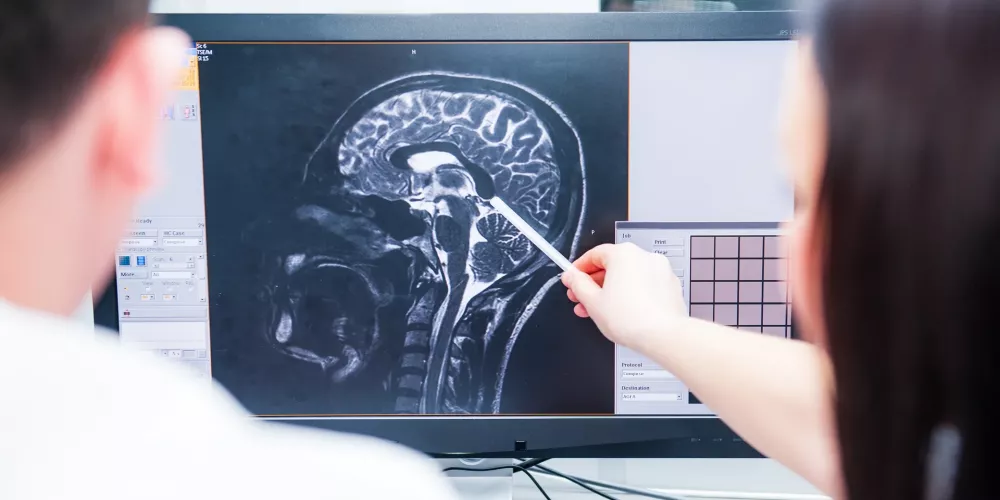 علماء يتمكنون من معرفة ما يدور في دماغ الإنسان عند الموت