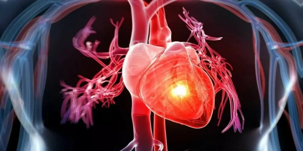هل يمكن تشخيص أمراض القلب بواسطة صوت الشخص؟