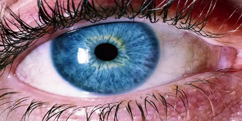 هل يمكن تشخيص عمى المخ عن طريق حركة حدقة العين؟ 