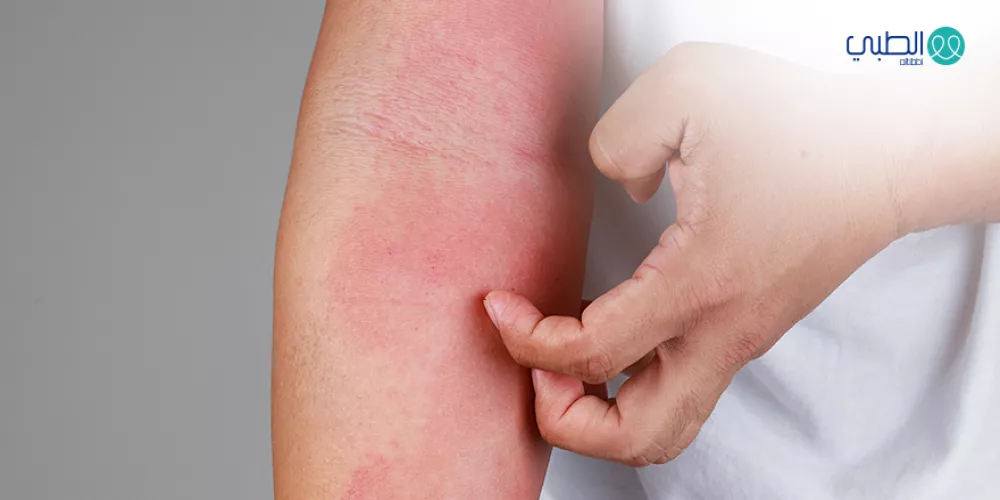 الأمراض الجلدية وعلاجها