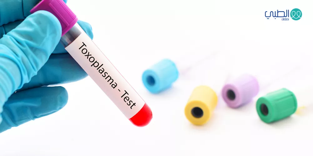 داء المقوسات