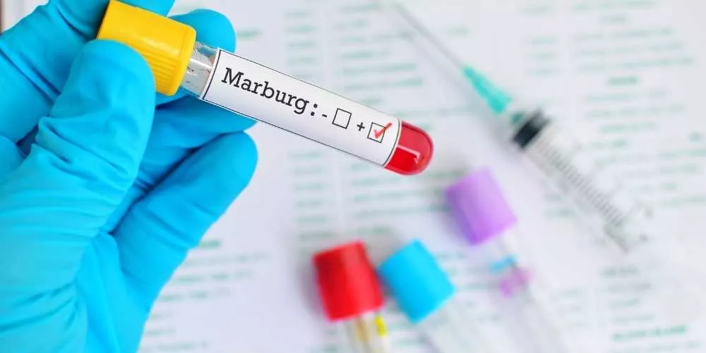 ماربورغ.. فيروس جديد يظهر في إفريقيا