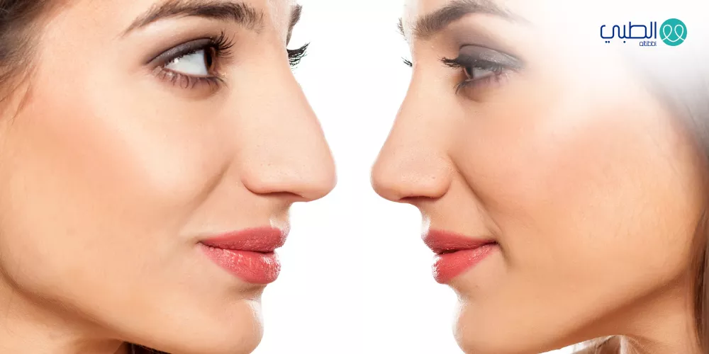 تجميل  الأنف  وتداعياته  النفسية 