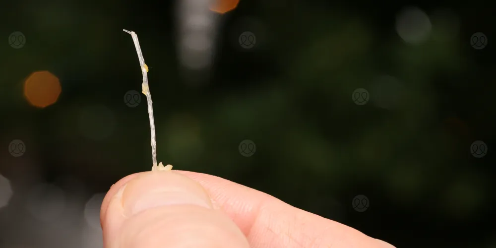 أضرار تعلق شوكة السمك في الحلق، وكيفية إزالتها في المنزل