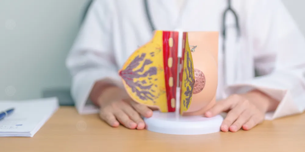 نزول دم من الثدي