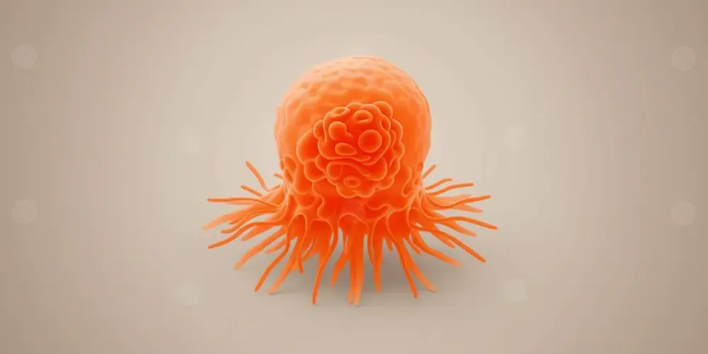 تجويع خلايا سرطان الثدي: كيف يبطئ تقليل الدهون نمو الورم؟