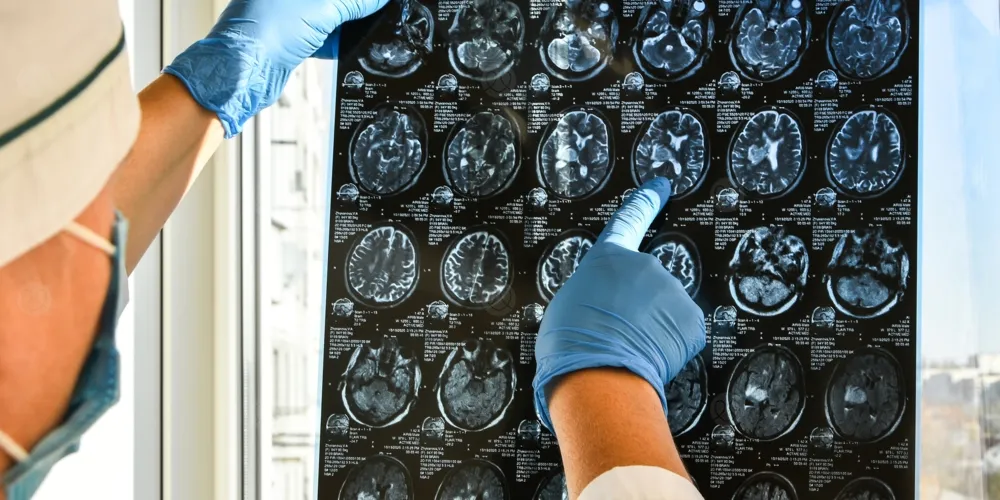 حقن سائل مغناطيسي في القلب لمنع السكتة الدماغية قبل حدوثها!