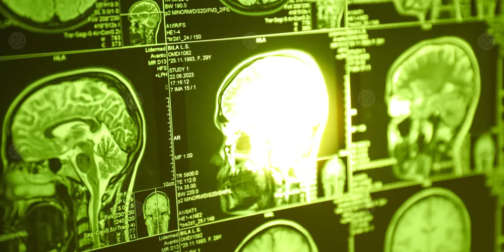 اكتشاف صادم: خلايا في الدماغ قد تغذّي السرطان