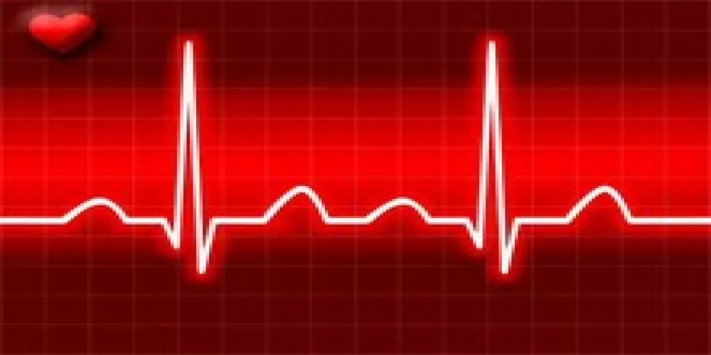 الأدوية التي تعالج مشاكل نبضات القلب لها تأثير في تخفيض الخرف   