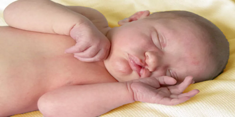 توقف التنفس واختلال النوم أكثر شيوعا عند الأطفال المصابين بالحنك المشقوق