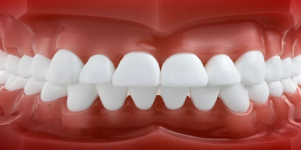 البوتوكس قد يمنع احتكاك الاسنان اثناء النوم 