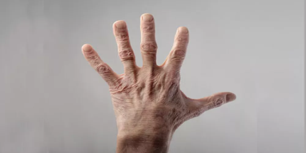 فيتامين ك 2 قد يساعد مرضى الباركنسون