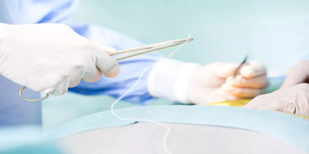 التوصول إلى تقنيية أفضل لالتئام جروح العمليات الجراحية