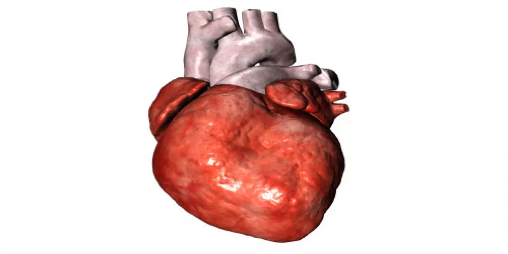 تطعيم خلايا عضل القلب يزيل اضطرابات نظم القلب بعد النوبات القلبية