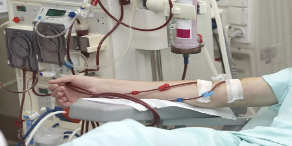 اجهزة الديال الدموي المنزلية الجديدة اسهل استخدام للمصابين بامراض الكلى 