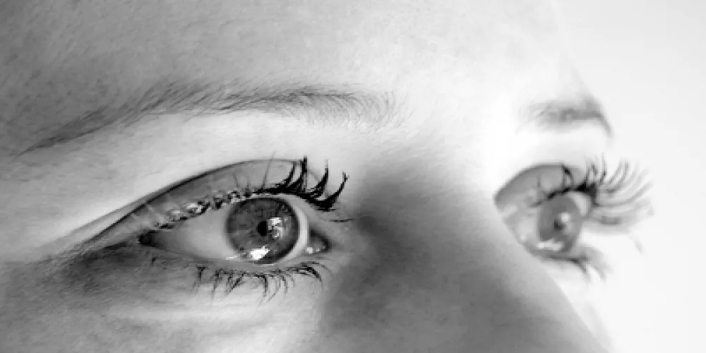 شيوع جفاف العين بعد عملية رفع الجفن التجميلية 