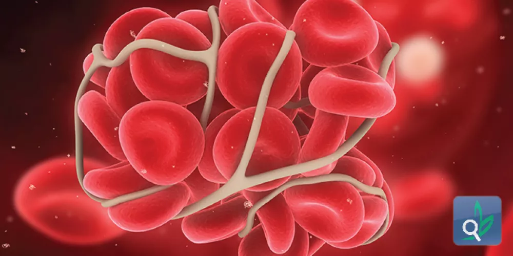  الستيرويدات تزيد من احتمال الاصابة بجلطات الدم 
