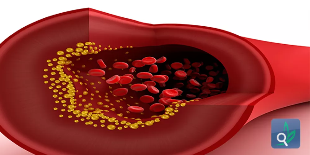 عقار دوائي جديد للوقاية من تجلط الدم 