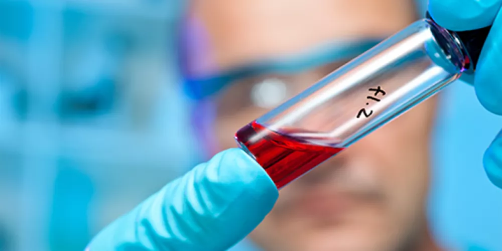 لقاح الملاريا للأطفال يجلب بعض الأمل 