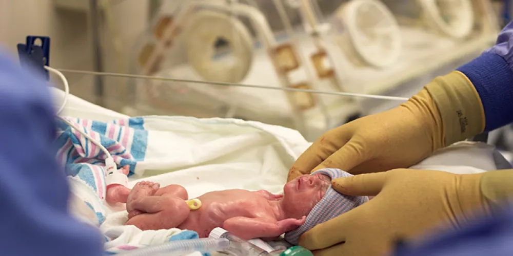 الولادة المُبكرة تعيق عمليات التطور الدماغي الحيوية