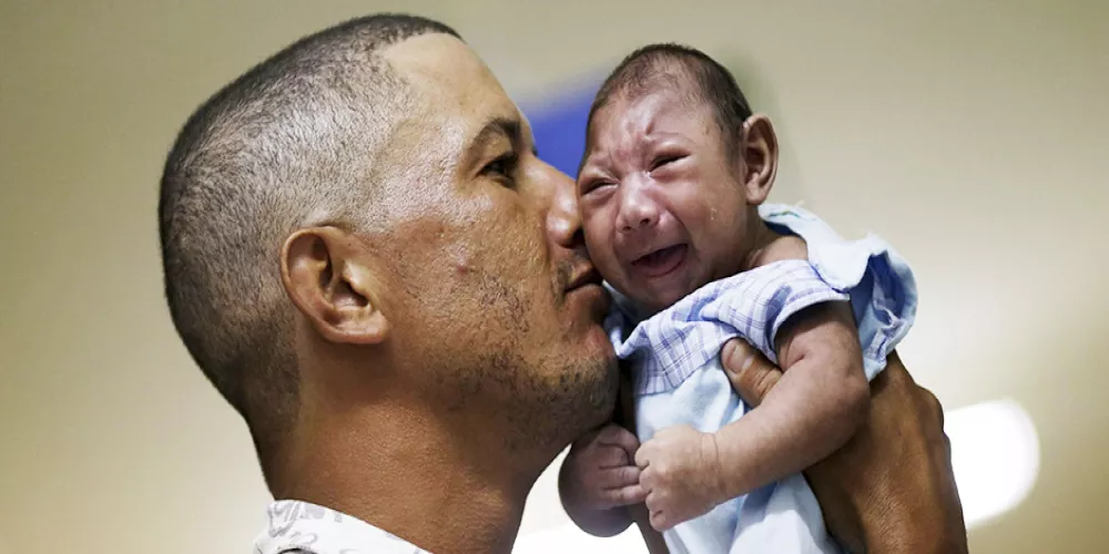 أول حالة لمولود يعاني من تشوهات فيروس زيكا في اسبانيا