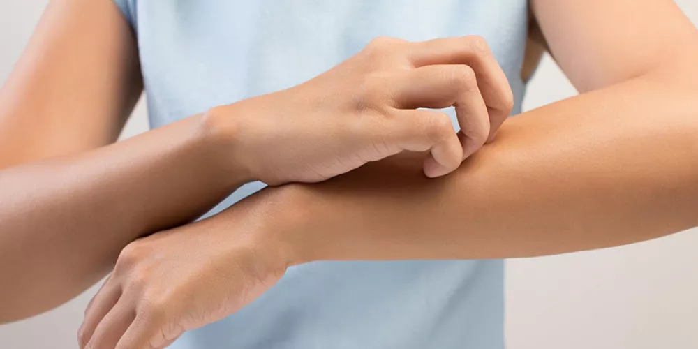 ما هي الأسباب المتوقعة لظهور طفح جلدي على الجسم؟