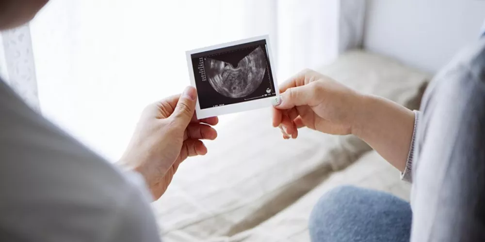هل تزداد مشاكل الحمل إذا كان الجنين ذكراً؟
