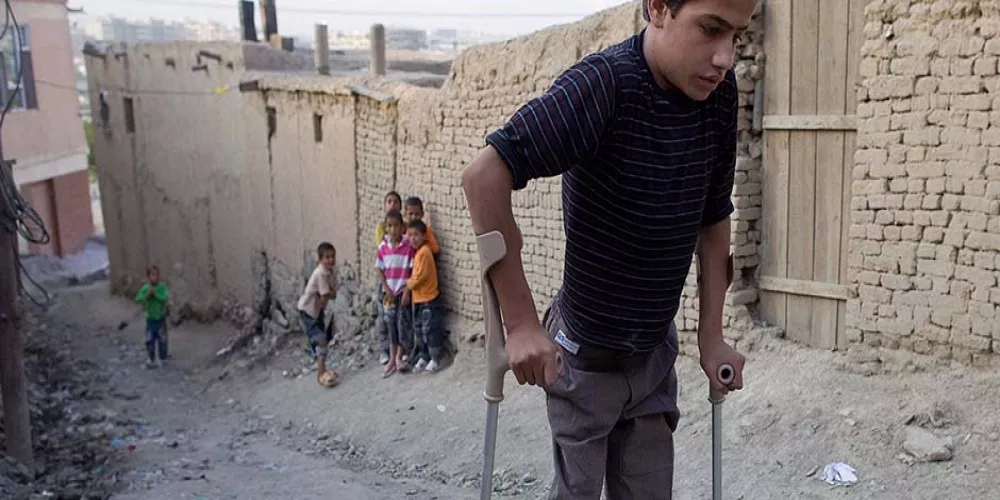 توقع زيادة حالات شلل الأطفال بين السوريين 