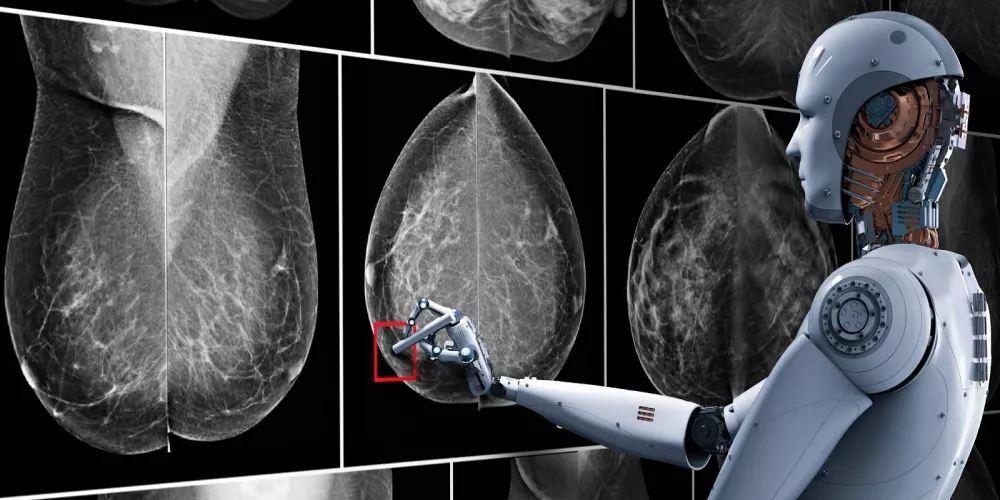 نموذج الذكاء الاصطناعي لمعهد ماساتشوستس للتكنولوجيا تعرّف على سرطان الثدي بدقة تماثل أخصائي الأشعة